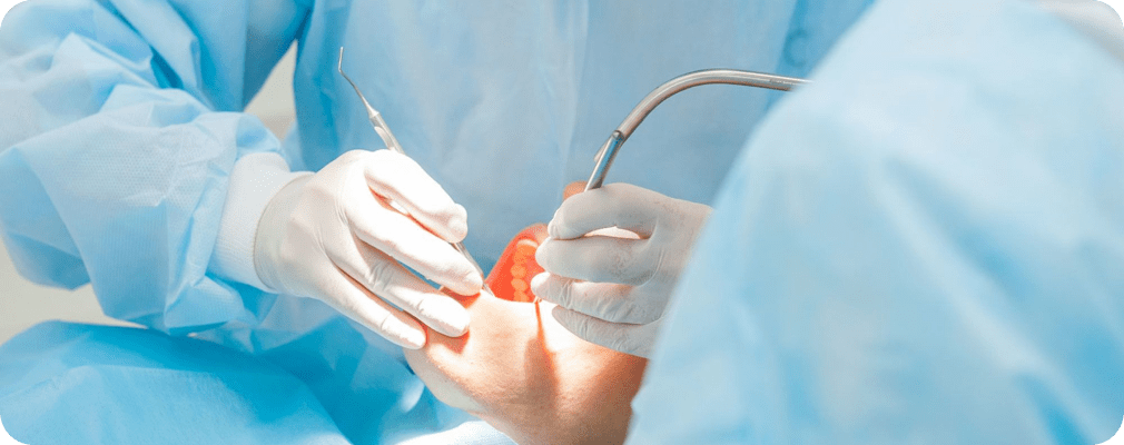 Dentiste Vincennes 94300 implant dentaire