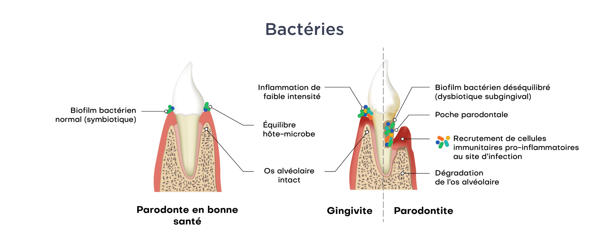 Dentiste Vincennes 94300 soin de gencives