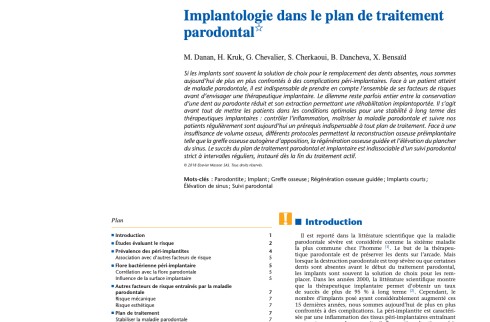 Implantologie dans le plan de traitement parodontal au cabinet Titane à Vincennes