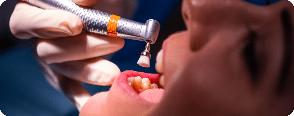 Dentiste Vincennes 94300 soin de gencives